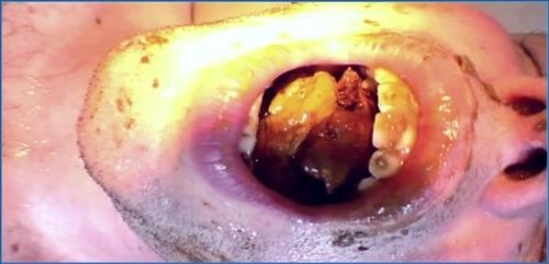 Toilet Slave Works P3 HD 720p - Lady Amy und Lady Atropa in Femdom und Scat Action