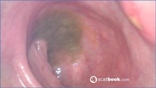 Sweet Tinqerbell + Endoskop + im Arsch FullHD 1080p – Scat-Slaves poster