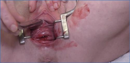 Toilet Play with Dirtygardengirl: Period, Peehole & Prolapse - scat porn video at Scat-Slaves.net