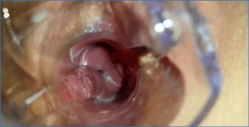 Shit Eating Anna Coprofield Uses Speculum to Fill Pussy - scat porn video at Scat-Slaves.net